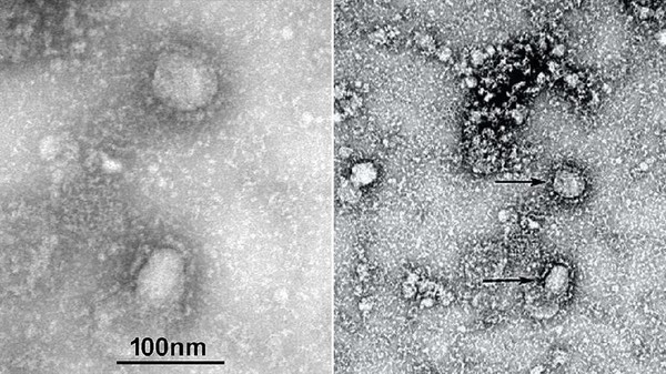 Keanehan Virus Corona: Ada Tambahan Misterius