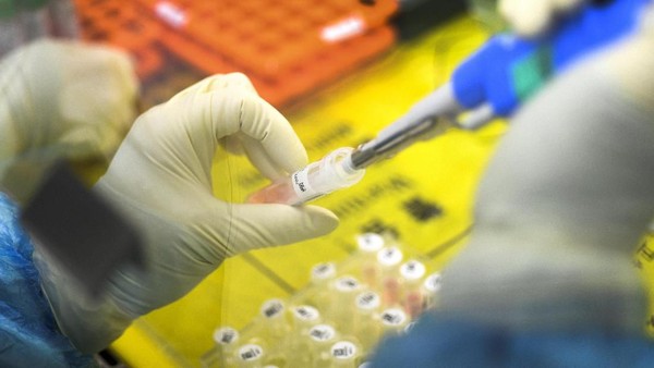 Isolat SARS-CoV-2 Belum Ada, Kok Bisa Kementan Bikin Antivirus Corona?