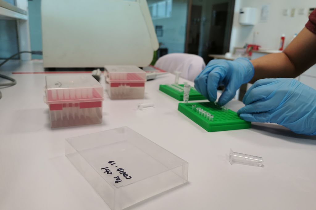 Prototipe Test Kit qPCR COVID-19 Buatan Indonesia Rampung