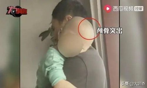 Susu Palsu dari Bubuk Suplemen Akibatkan Kepala Anak-anak di China Membesar