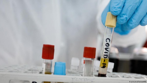 Uji Coba Sukses! Vaksin Corona China Hasilkan Antibodi COVID-19 dalam 14 Hari