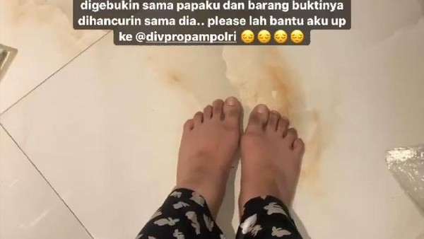 Bongkar Kelakuan Sang Ayah, Anak Kombes Rachmat Widodo Jadi Tersangka