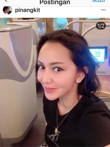 Gaya Hidup Pinangki Disorot: Diduga Operasi Hidung, Perhiasan hingga BMW