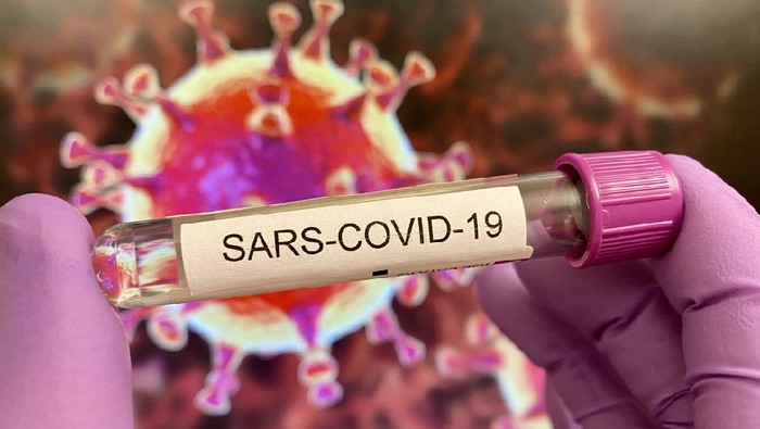 Ahli Virologi Bantah Prof Nidom soal COVID-19 Buatan: Ini Buatan Alam 