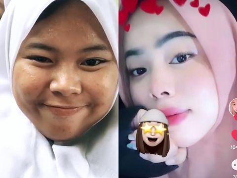 Rahasia Remaja Glow Up dalam 2 Tahun Bikin Penasaran! Dulu Jerawatan Kini Mulus!