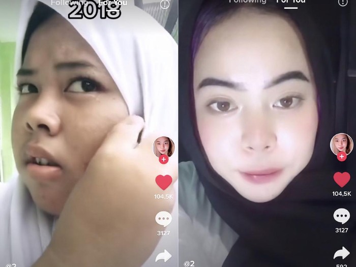 Rahasia Remaja Glow Up dalam 2 Tahun Bikin Penasaran! Dulu Jerawatan Kini Mulus!