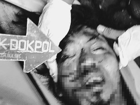 Penampakan Wajah Terduga Pelaku Bom Bunuh Diri di Makassar 