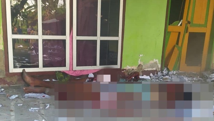 Petasan 8 Kg Meledak di NTB saat Lebaran, 2 Pria Alami Luka Bakar-Jari Putus