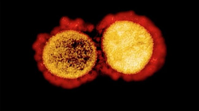 peneliti-china-beberkan-30-mutasi-baru-virus-corona