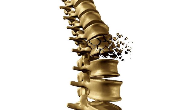 7 Makanan Pencegah Osteoporosis