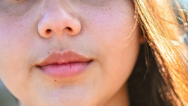 Hirsutisme, Saat Wanita Punya Kumis dan Rambut Dada