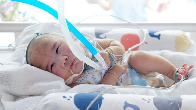 Dandy Walker Syndrome, Penyakit Sporadis yang Mengambil Adam Fabumi