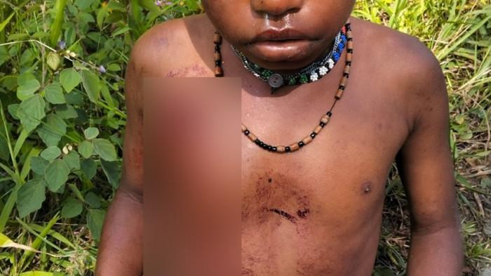 Penembakan Brutal di Puncak Papua, Amnesty International Desak Evaluasi Keamanan