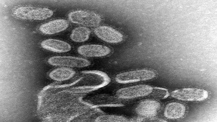 Mengenal Virus H3N2 yang Jadi Pemicu Kasus Flu Meroket di Indonesia