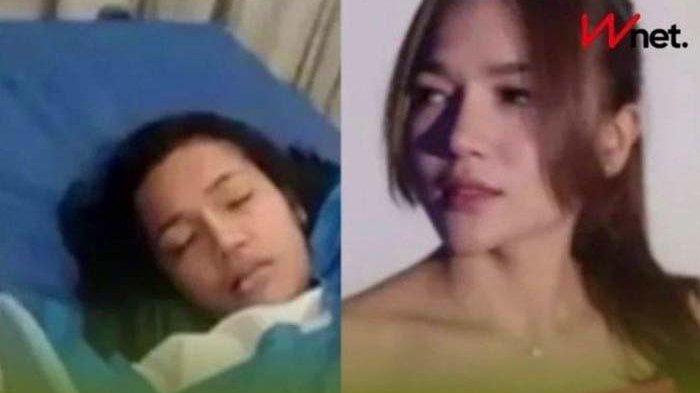 Wanita Medan Tewas Usai Sedot Lemak di Depok, Polisi: Pembuluh Darah Pecah
