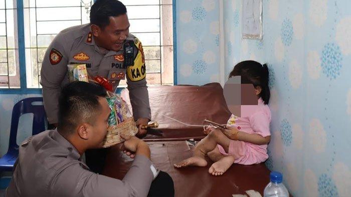 Bocah Perempuan di Nias Disiksa Keluarga , Polisi Syok Lihat Kondisi Kaki Korban