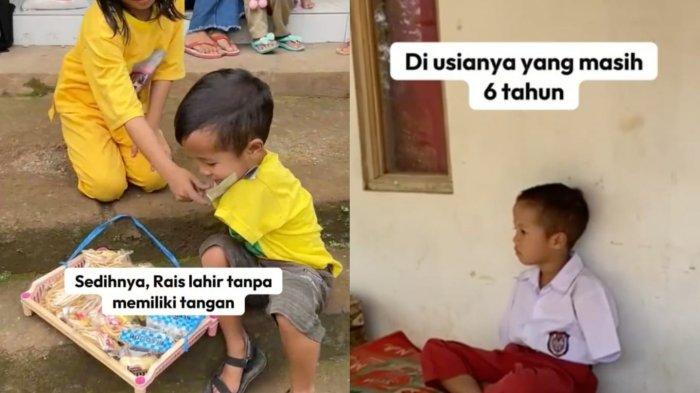 Kisah Pilu Rais Bocah Difabel 6 Tahun Jual Makanan, Ibu Kabur, Hidupi Neneknya