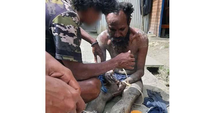 Jubir OPM: Alex Sondegau dalam Gangguan Jiwa Ditangkap Militer di Intan Jaya