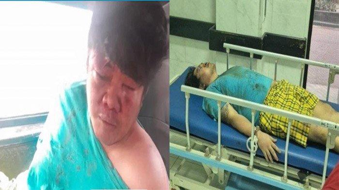 'Sudah Mau Meninggal Gitu Kok Diborgol' Tak Kuasa Melihat Anaknya Dianiaya