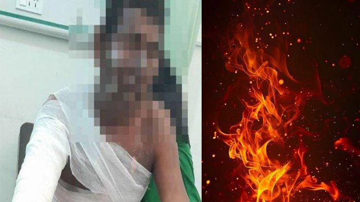 Ditolak Berhubungan Suami Istri, Pria di Anambas Bakar Diri Depan Anak, Sudah 4 Hari