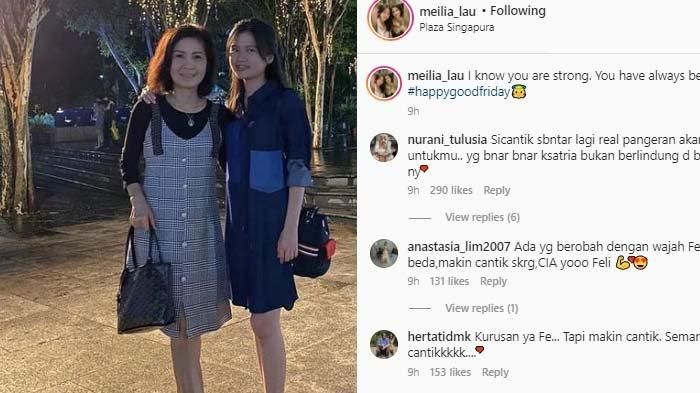 Dipuji Semakin Cantik, Intip Potret Terbaru Felicia Tissue Usai Putus dari Kaesang