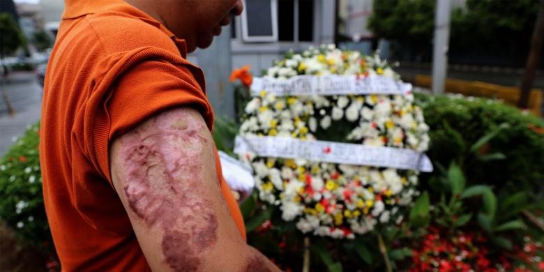 Polisi Korban Bom Thamrin: Kini Tak Bisa Sujud dan Tuli Sebagian