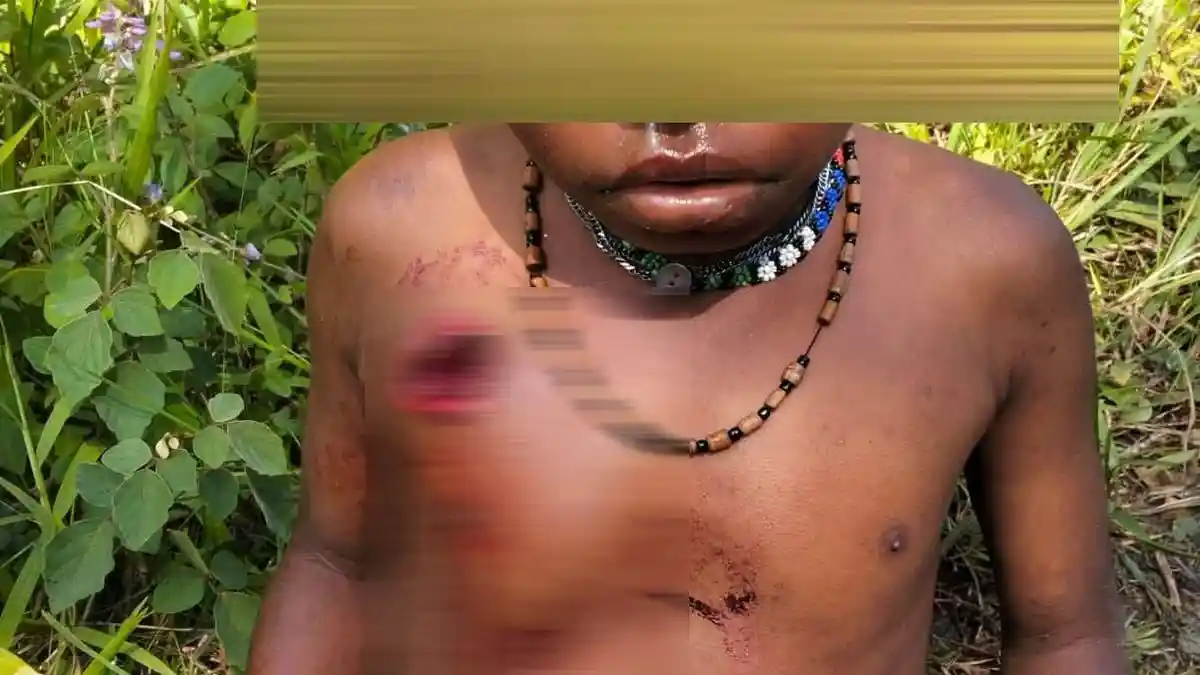 Penembakan Brutal di Puncak Papua, Amnesty International Desak Evaluasi Keamanan