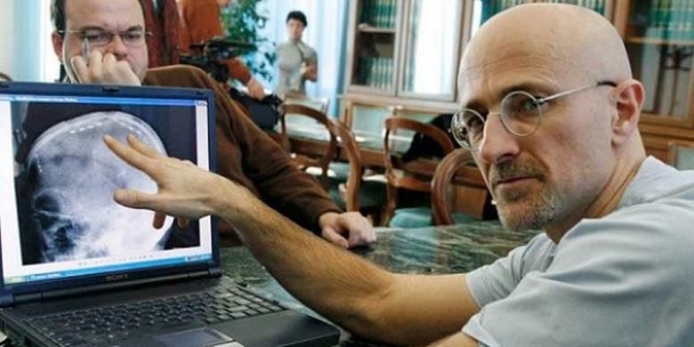 Eksperimen Berhasil, Akankah Transplantasi Kepala Jadi Kenyataan?