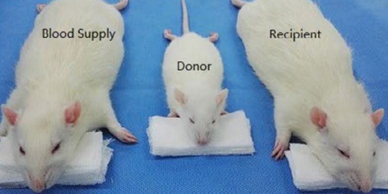 Eksperimen Berhasil, Akankah Transplantasi Kepala Jadi Kenyataan?