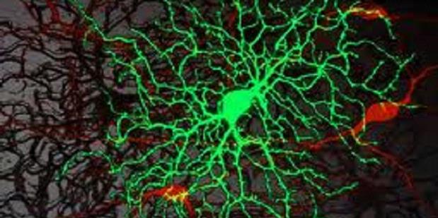 Begini Cara Sel Otak Cegah Kerusakan Akibat Stroke