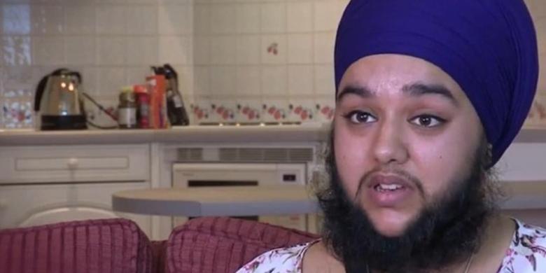 WOW, Perempuan Ini Merasa Cantik dengan Janggut di Wajahnya