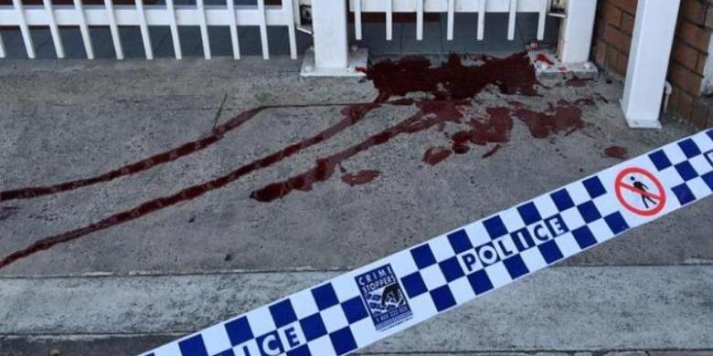 Tiga KJRI di Australia Dikirimi Bubuk Putih