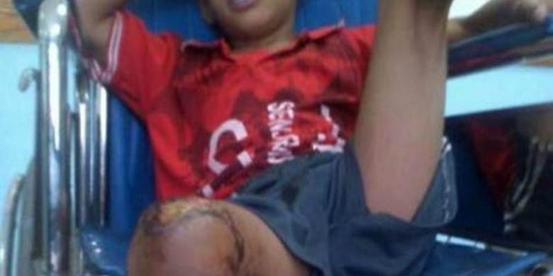 Terinspirasi ISIS, Sekelompok Bocah di Yaman Bakar Kawannya