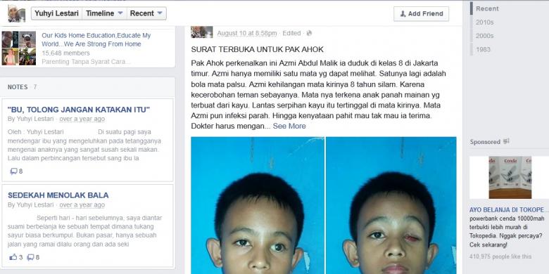 Berkat "Surat Terbuka untuk Pak Ahok", Lurah hingga Bazis Bantu Azmi