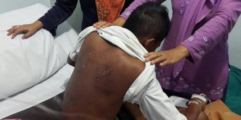 ngeri : Dituduh Curi Burung, Bocah Kelas VI SD Diduga Dipukuli Oknum TNI AL