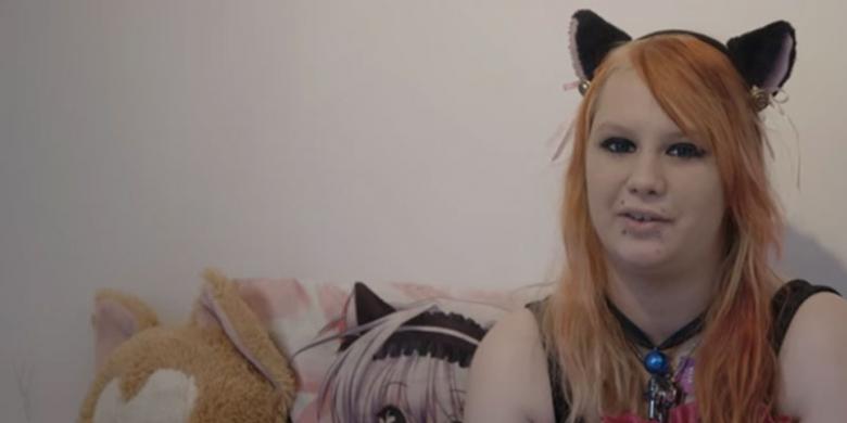Cacat Genetik, Gadis Ini Merasa Jadi Seekor Kucing