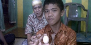 Kembali "Bertelur", Akmal Akhirnya Diperiksakan ke Rumah Sakit