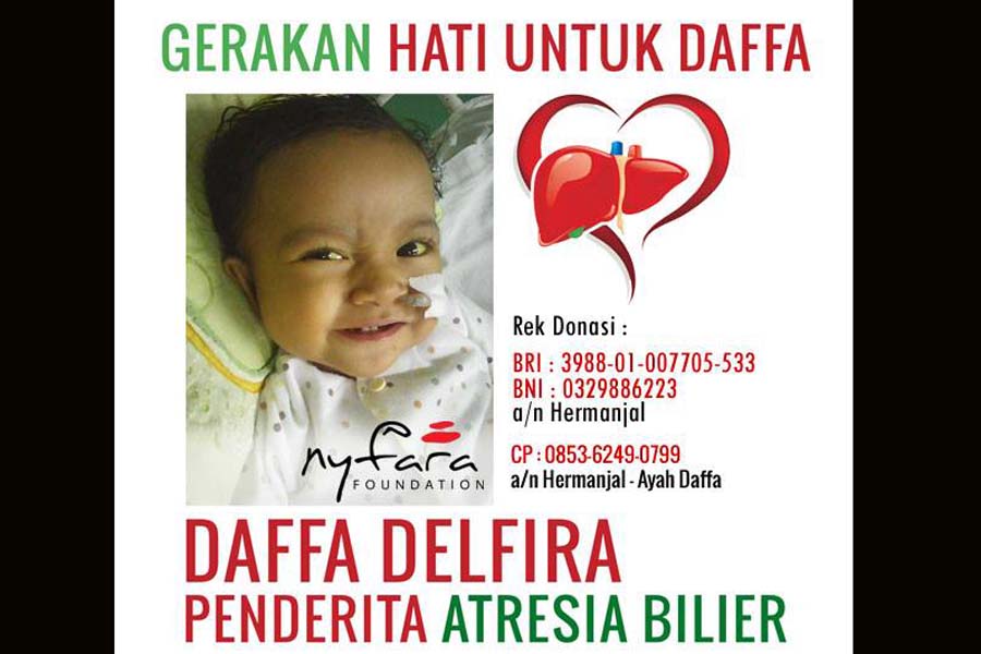 baksospeduli-daffa-delfira-penderita-atresia-bilier