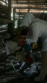 Tolak Penanganan Medis, 2 Balita Gizi Buruk Asmat Meninggal Dunia