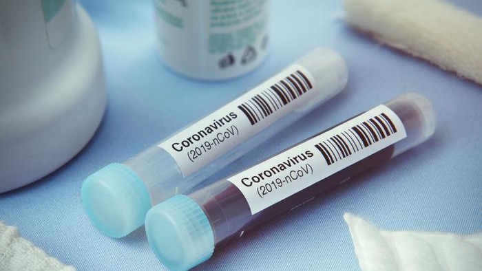 Pemerintah Indonesia Sudah Sediakan Obat Virus Corona
