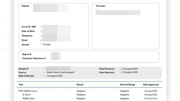 Viral Dokumen COVID-19 HRS Disebut Palsu, Seperti Apa Sih Hasil Tes Asli?