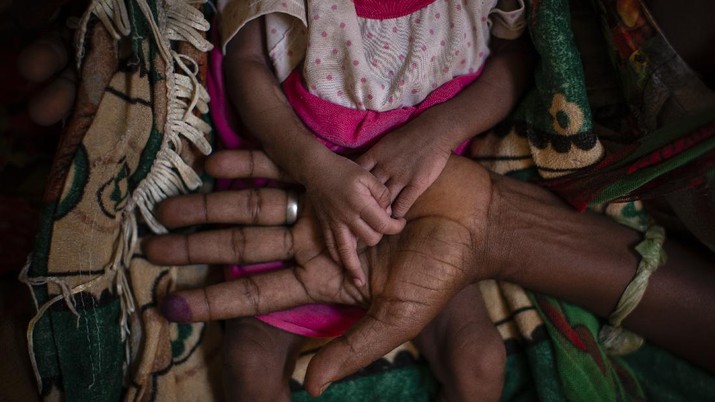 Miris! Separuh Orang Lapar di Dunia Warga Asia, bukan Afrika