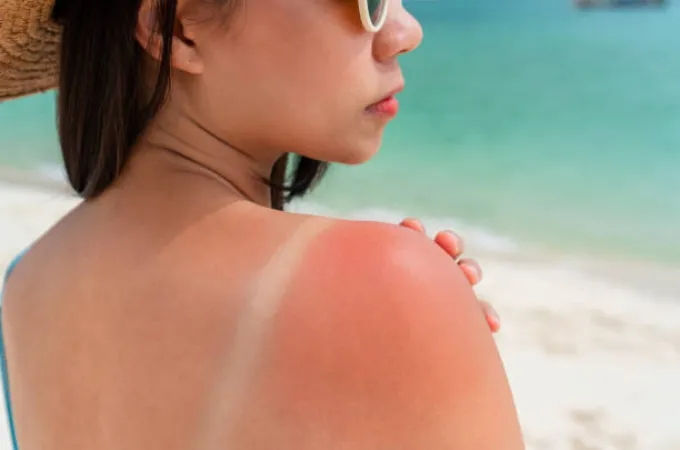 bahaya-tersembunyi-di-balik-sinar-matahari-dampak-buruk-tidak-menggunakan-sunscreen