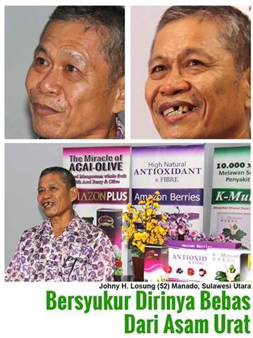 Kesembuhan Penyakit Asam Urat Dengan Herbal Alami
