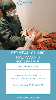 Rekomendasi Beauty Clinic Anti Aging di Bandung 2022