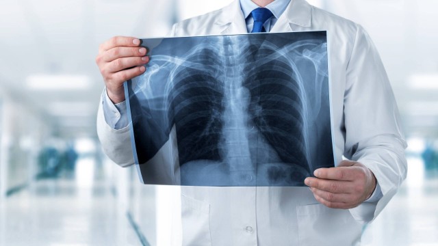 Indonesia Darurat Dokter Spesialis, Apa Penyebabnya?