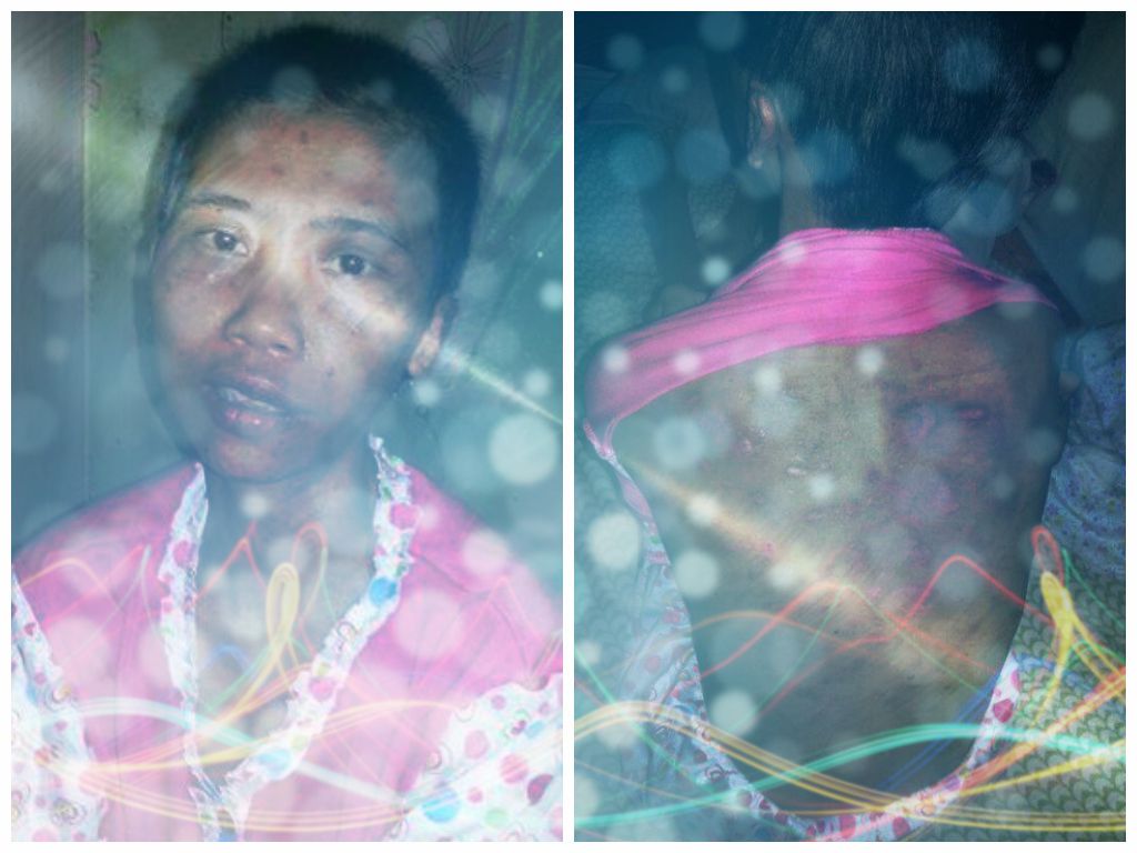 tkw-sukabumi-disiksa-sampai-lumpuh-di-arab-saudi