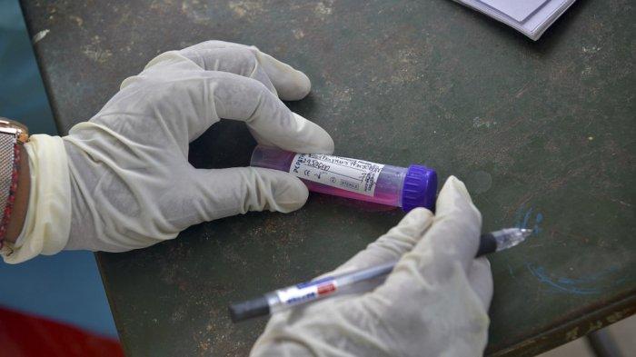 Petugas Penanganan Covid-19 di Riau Mulai Jenuh Tracing Pasien