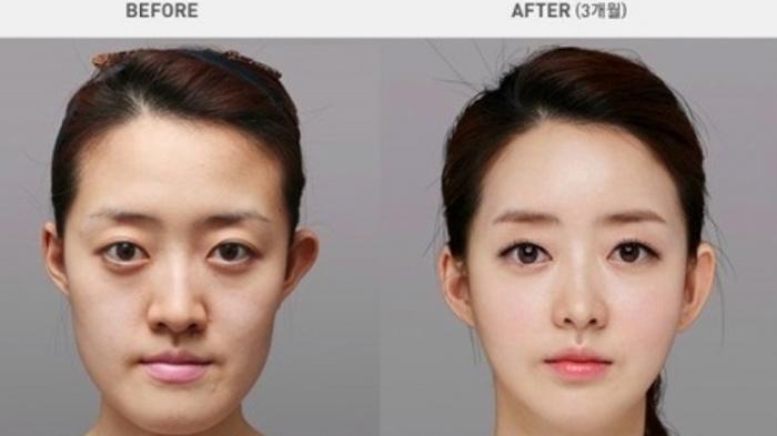 before-after-plastic-surgery-vs-make-up-which-one-you-choose