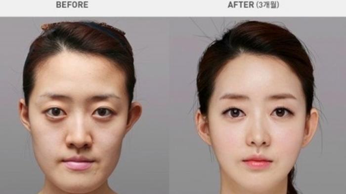 BEFORE AFTER ...PLASTIC SURGERY VS MAKE UP... WHICH ONE YOU CHOOSE?